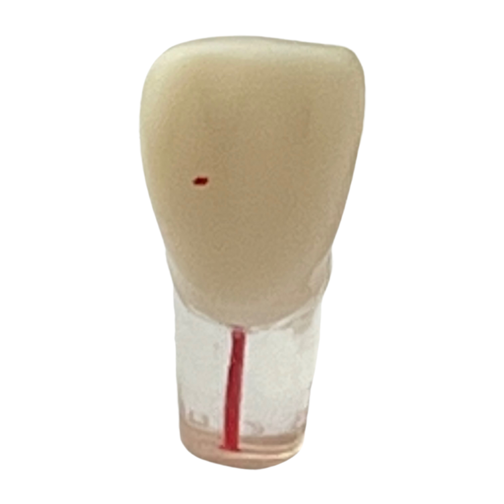 Dientes Endodoncia C/5 P/ TN-A8011 28 dientes DT (Tipo Nissin)