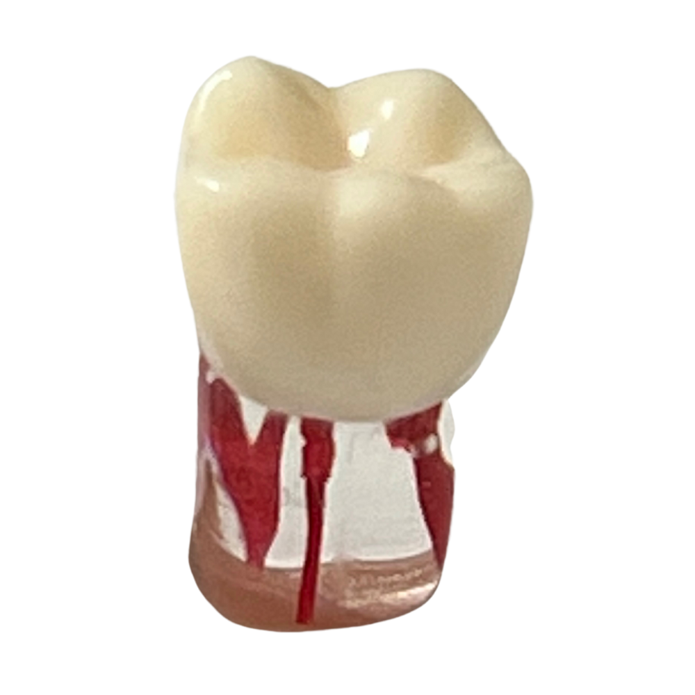 Dientes Endodoncia C/5 P/ TN-A8011 28 dientes DT (Tipo Nissin)