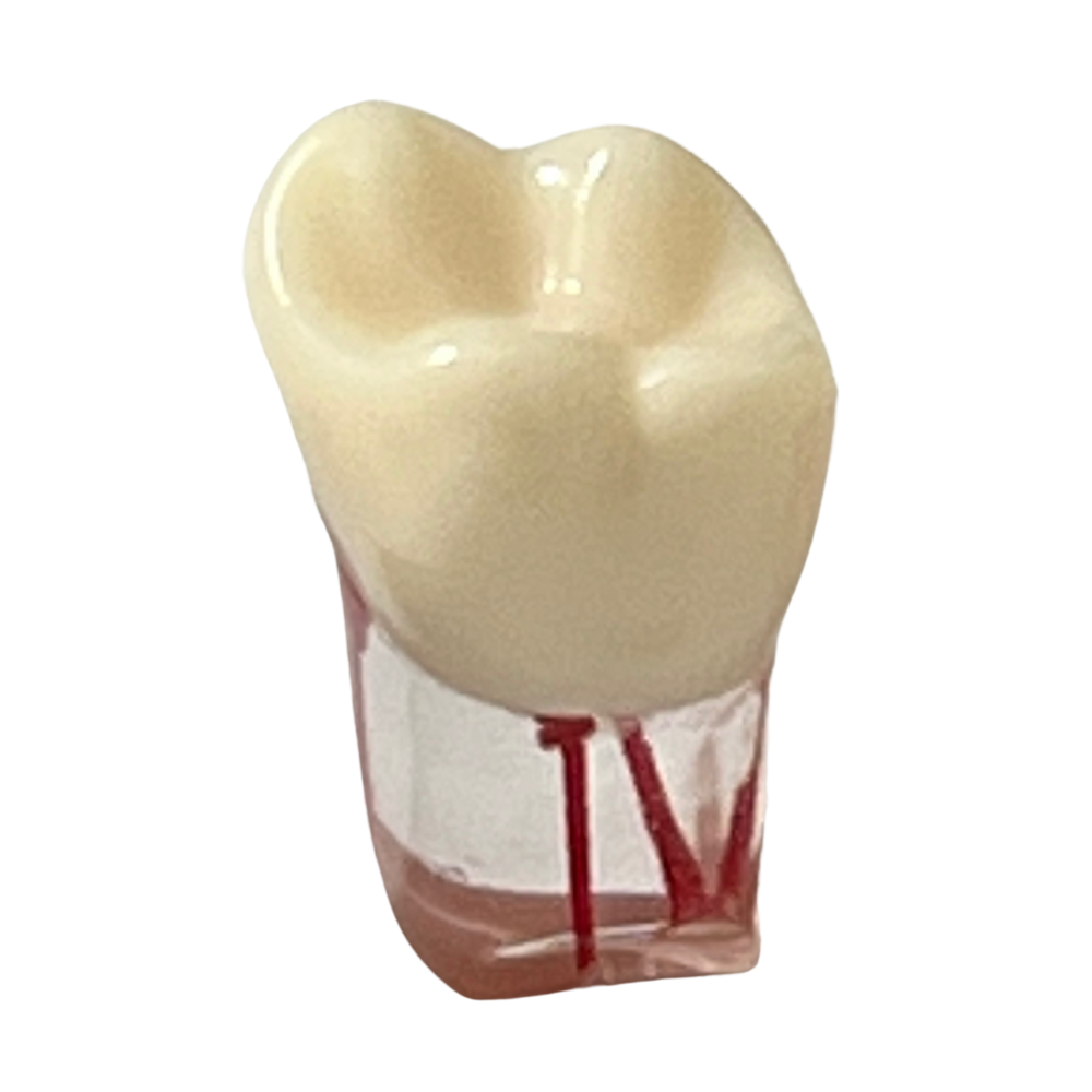 Dientes Endodoncia C/5 P/ TN-A8011 28 dientes DT (Tipo Nissin)