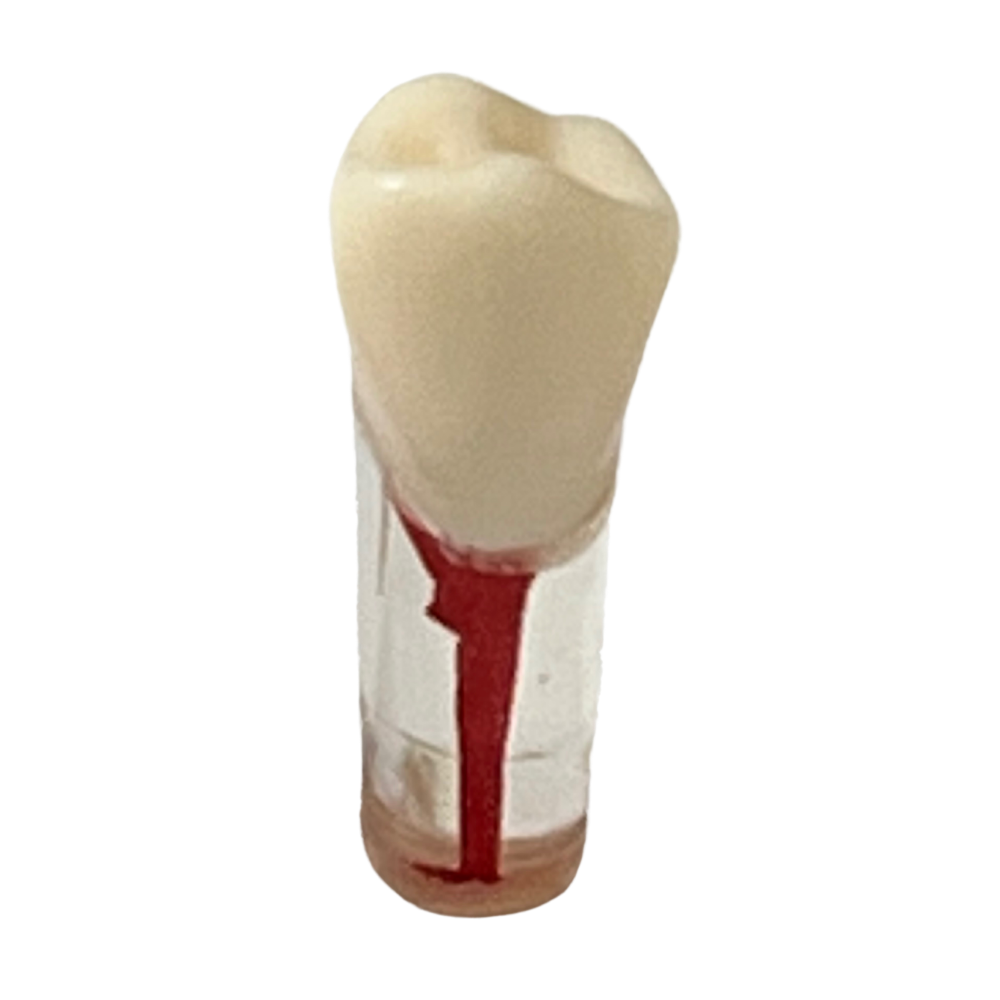 Dientes Endodoncia C/5 P/ TN-A8011 28 dientes DT (Tipo Nissin)