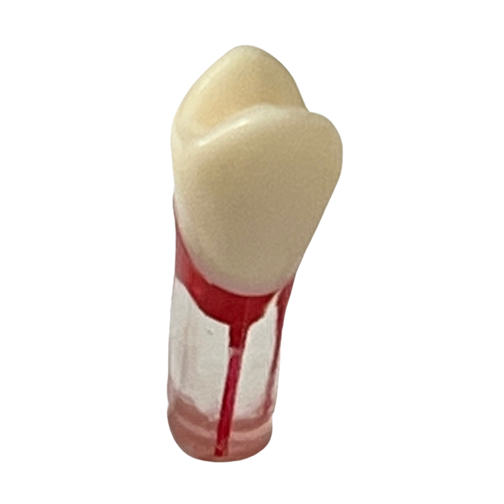 Dientes Endodoncia C/5 P/ TN-A8011 28 dientes DT (Tipo Nissin)